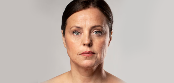 Anti-Wrinkle Injections